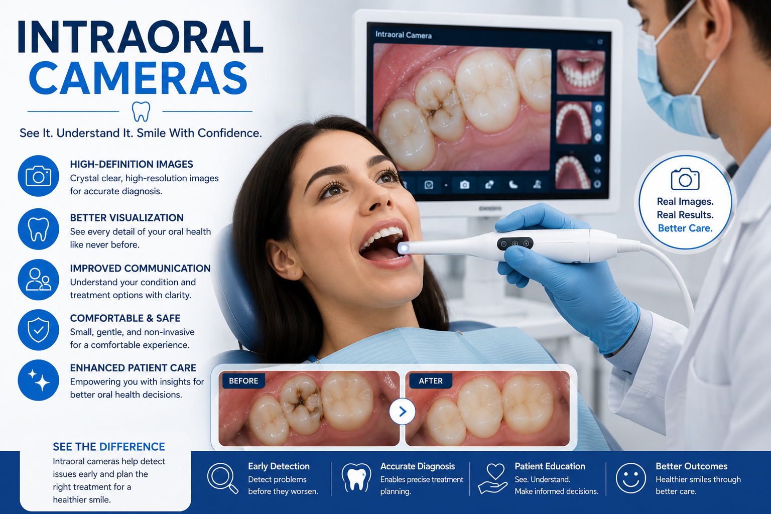 Intraoral Cameras